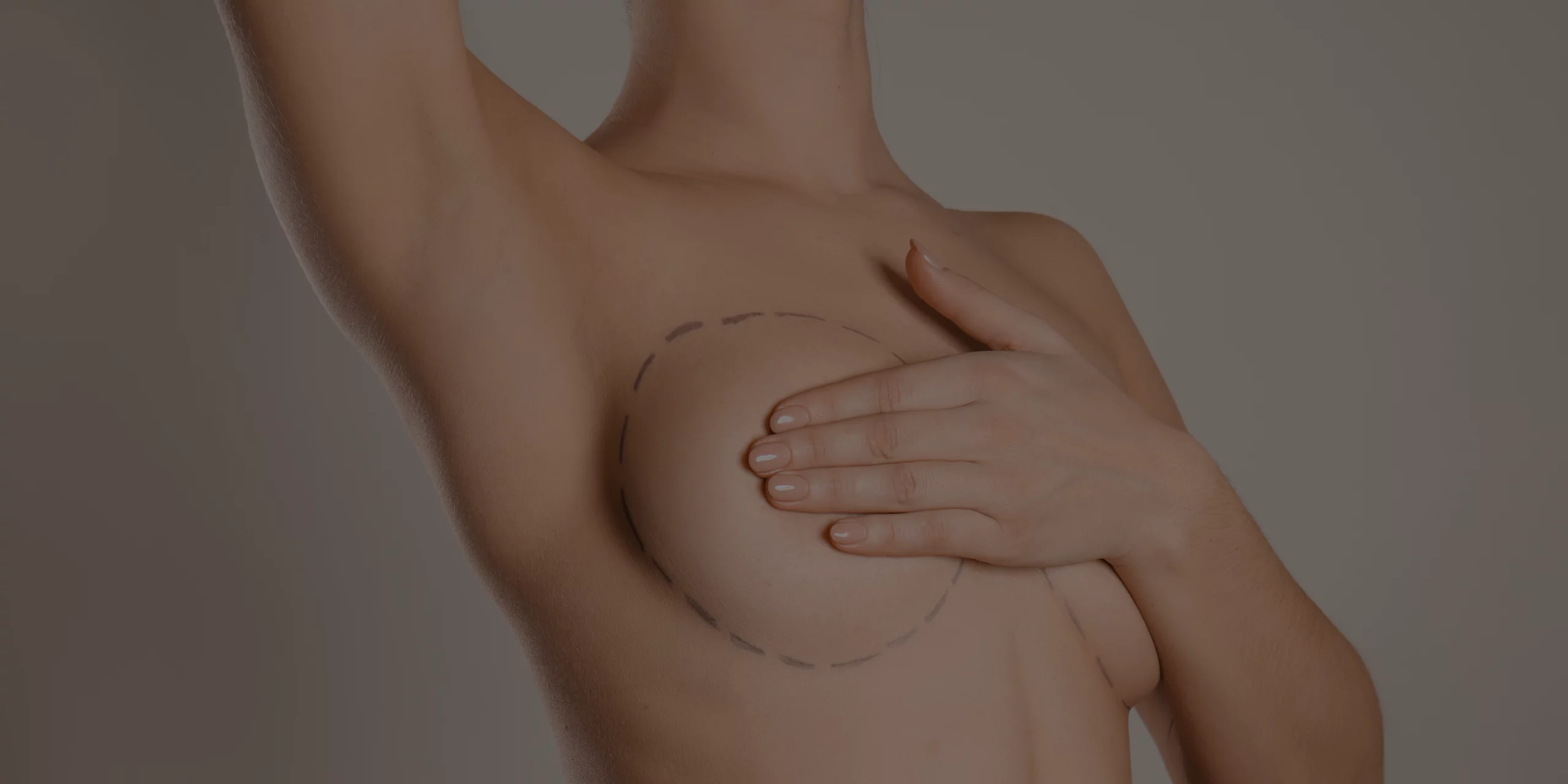 Chirurgie Esthétique des Seins